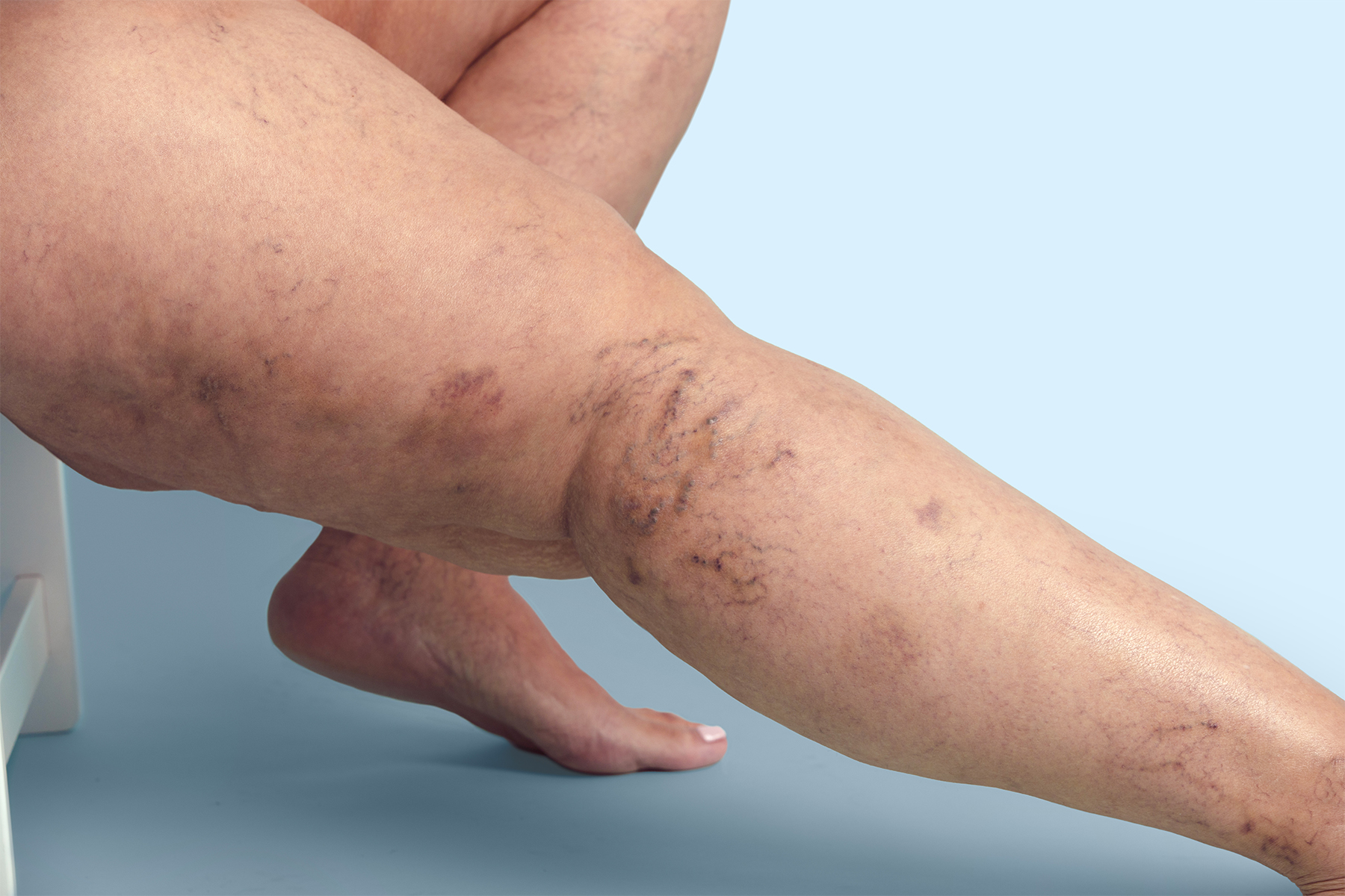 Explore las diferencias anatómicas y funcionales entre las venas del tobillo, el pie y la pierna, y aprenda cómo estas variaciones afectan la salud vascular.