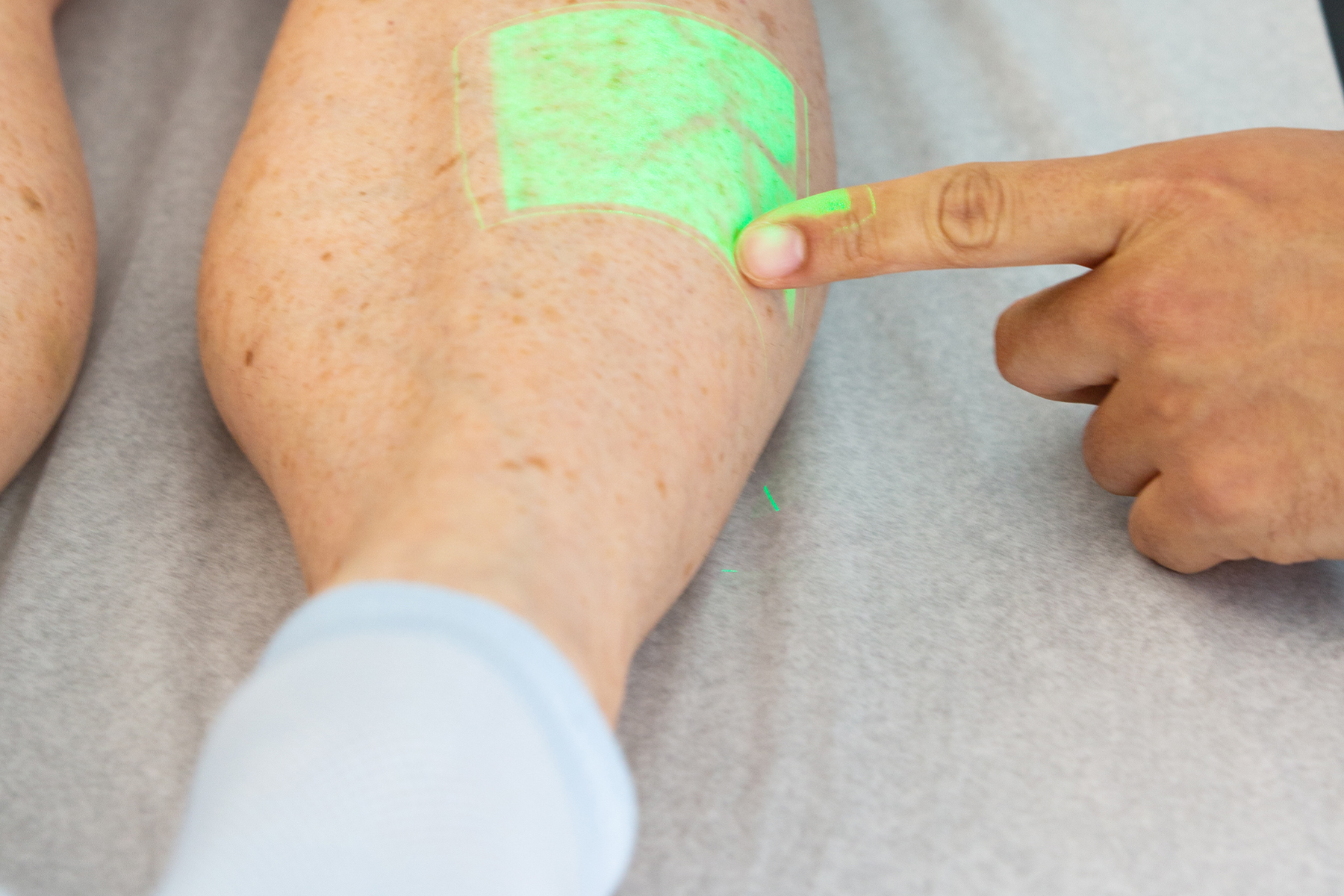 Aprende a identificar las complicaciones post-tratamiento después de procedimientos en las venas. Comprende los síntomas, recibe consejos para la recuperación y sabe cuándo buscar ayuda médica.